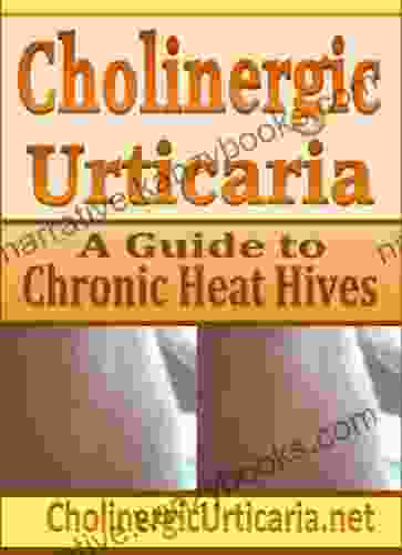 Cholinergic Urticaria: A Guide To Chronic Heat Hives